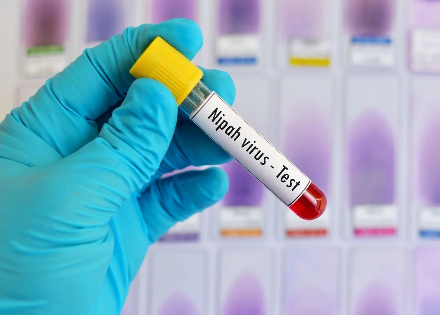 sample of nipah virus